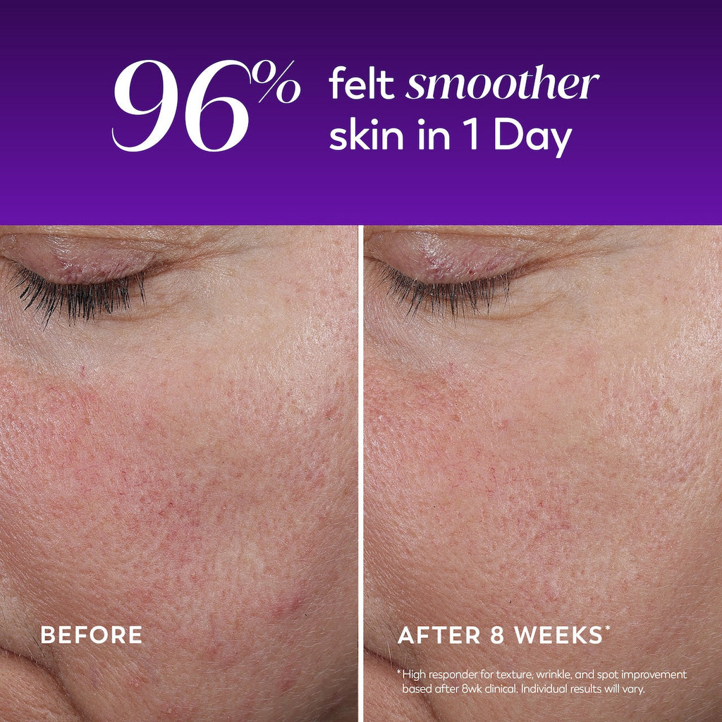 Regenerist Wrinkle Correcting Night Treatment