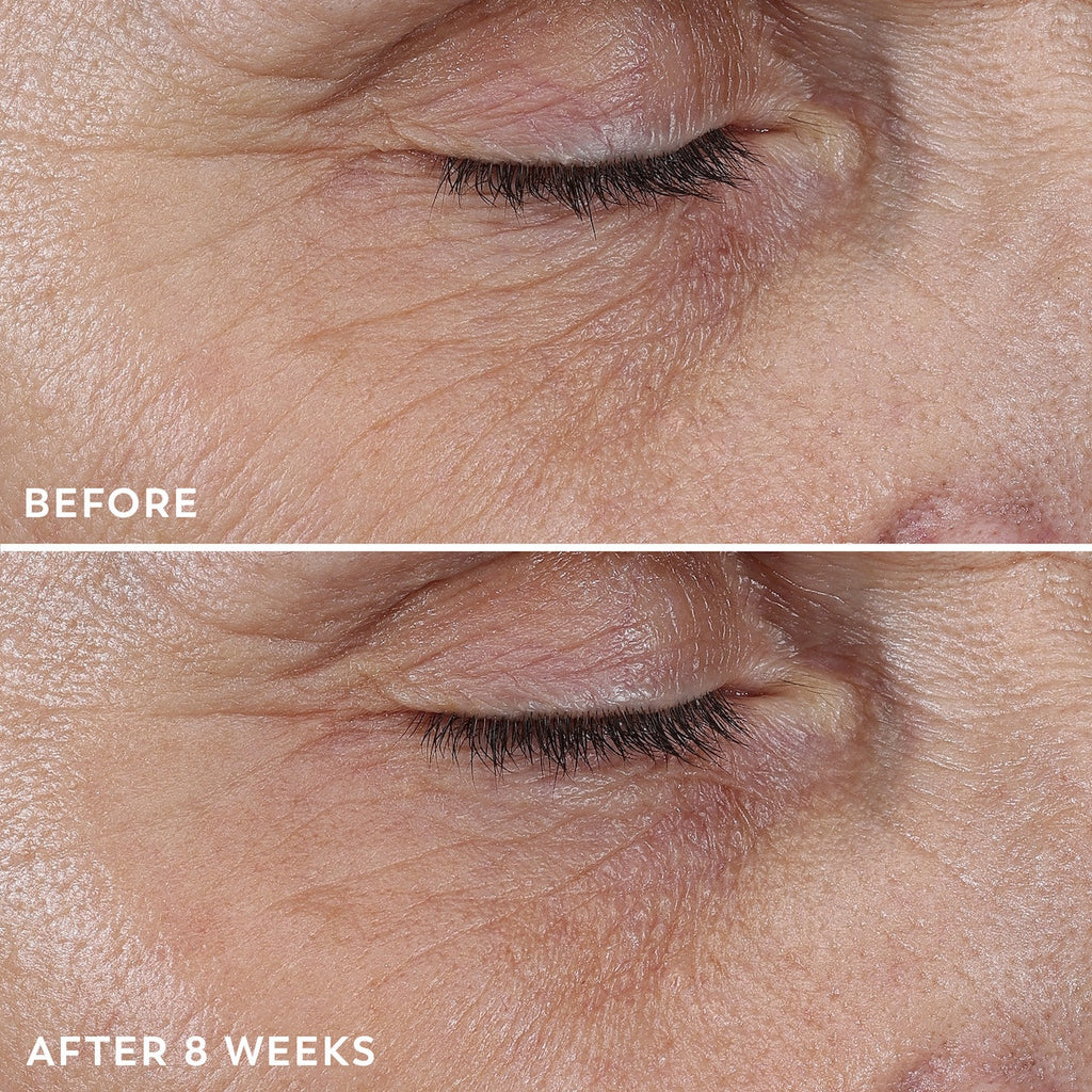 Regenerist Micro-Sculpting Cream Moisturizer